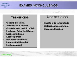 ↑BENEFÍCIOS
• Cicatriz x recidiva
• Assimetrias x lobular
• Cisto denso x nódulo sólido
• Lesão em única incidência
• Lesões múltiplas
• Lesões parede
• Mastopatia diabética
• Incompatibilidade BX
• Lesão palpável
 BENEFÍCIOS
• Mastite x Ca inflamatório
• Distorção da arquitetura
• Microcalcificações
EXAMES INCONCLUSIVOS
 