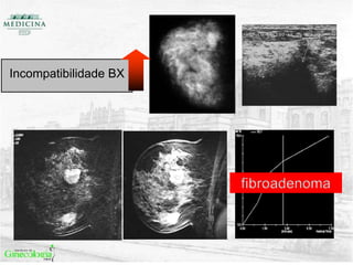 Incompatibilidade BX
 