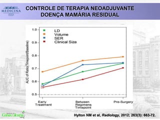 CONTROLE DE TERAPIA NEOADJUVANTE
DOENÇA MAMÁRIA RESIDUAL
Hylton NM et al, Radiology, 2012; 263(3): 663-72.
 