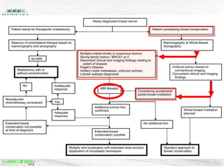 d algorithm for clinical application of MRI breast in newly diagnosed breast cancer based on curren
The American Journal of Surgery, Vol 197
 