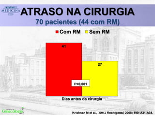 Krishnan M et al., Am J Roentgenol, 2008; 190: A31-A34.
ATRASO NA CIRURGIA
70 pacientes (44 com RM)
41
27
Dias antes da cirurgia
Com RM Sem RM
P=0,001
 