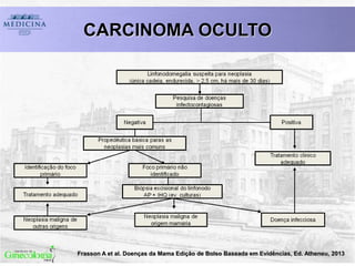 CARCINOMA OCULTO
Frasson A et al. Doenças da Mama Edição de Bolso Baseada em Evidências, Ed. Atheneu, 2013
 