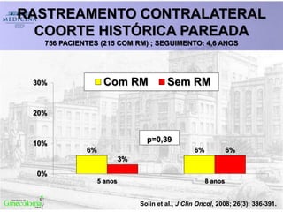 RASTREAMENTO CONTRALATERAL
COORTE HISTÓRICA PAREADA
756 PACIENTES (215 COM RM) ; SEGUIMENTO: 4,6 ANOS
6% 6%
3%
6%
0%
10%
20%
30%
5 anos 8 anos
Com RM Sem RM
p=0,39
Solin et al., J Clin Oncol, 2008; 26(3): 386-391.
 