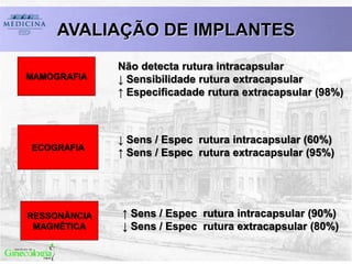 ECOGRAFIA
RESSONÂNCIA
MAGNÉTICA
MAMOGRAFIA
Não detecta rutura intracapsular
↓ Sensibilidade rutura extracapsular
↑ Especificadade rutura extracapsular (98%)
↓ Sens / Espec rutura intracapsular (60%)
↑ Sens / Espec rutura extracapsular (95%)
↑ Sens / Espec rutura intracapsular (90%)
↓ Sens / Espec rutura extracapsular (80%)
AVALIAÇÃO DE IMPLANTES
 