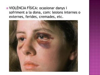  VIOLÈNCIA

FÍSICA: ocasionar danys i
sofriment a la dona, com: lesions internes o
externes, ferides, cremades, etc.

 