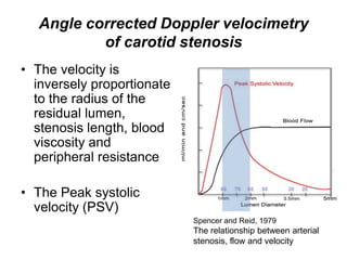 Angle corrected Doppler velocimetry
          of carotid stenosis
• The velocity is
  inversely proportionate
  to the radius of the
  residual lumen,
  stenosis length, blood
  viscosity and
  peripheral resistance

• The Peak systolic
  velocity (PSV)
                            Spencer and Reid, 1979
                            The relationship between arterial
                            stenosis, flow and velocity
 