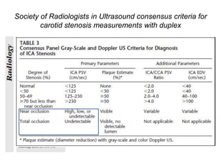 Society of Radiologists in Ultrasound consensus criteria for
        carotid stenosis measurements with duplex
 