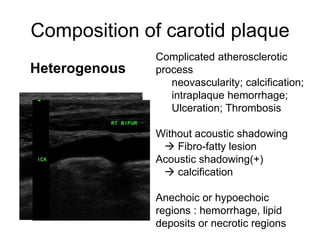 Composition of carotid plaque
               Complicated atherosclerotic
Heterogenous   process
                  neovascularity; calcification;
                  intraplaque hemorrhage;
                  Ulceration; Thrombosis

               Without acoustic shadowing
                 Fibro-fatty lesion
               Acoustic shadowing(+)
                 calcification

               Anechoic or hypoechoic
               regions : hemorrhage, lipid
               deposits or necrotic regions
 