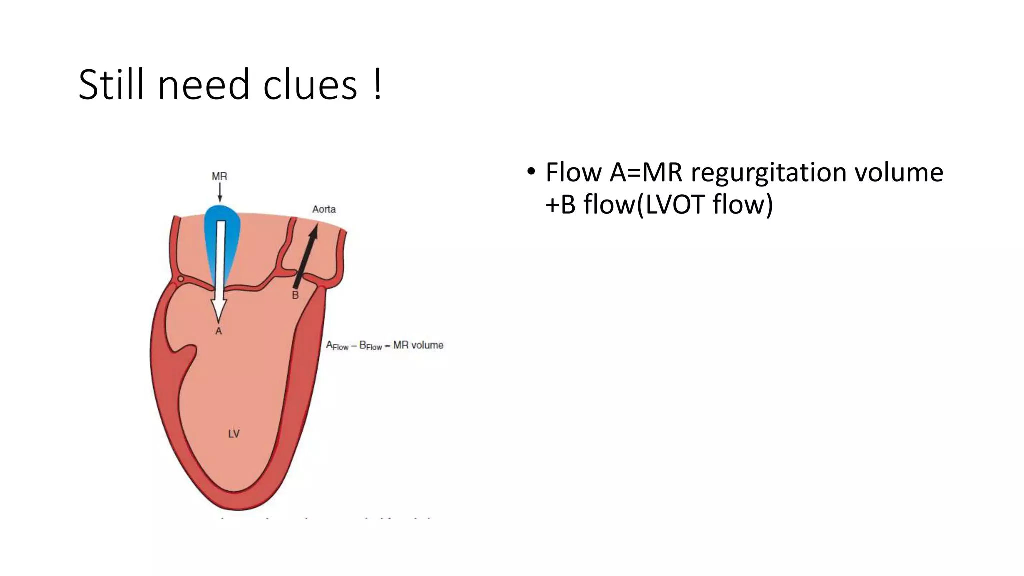 Quantification of mitral regurgitation by PISA | PPTX