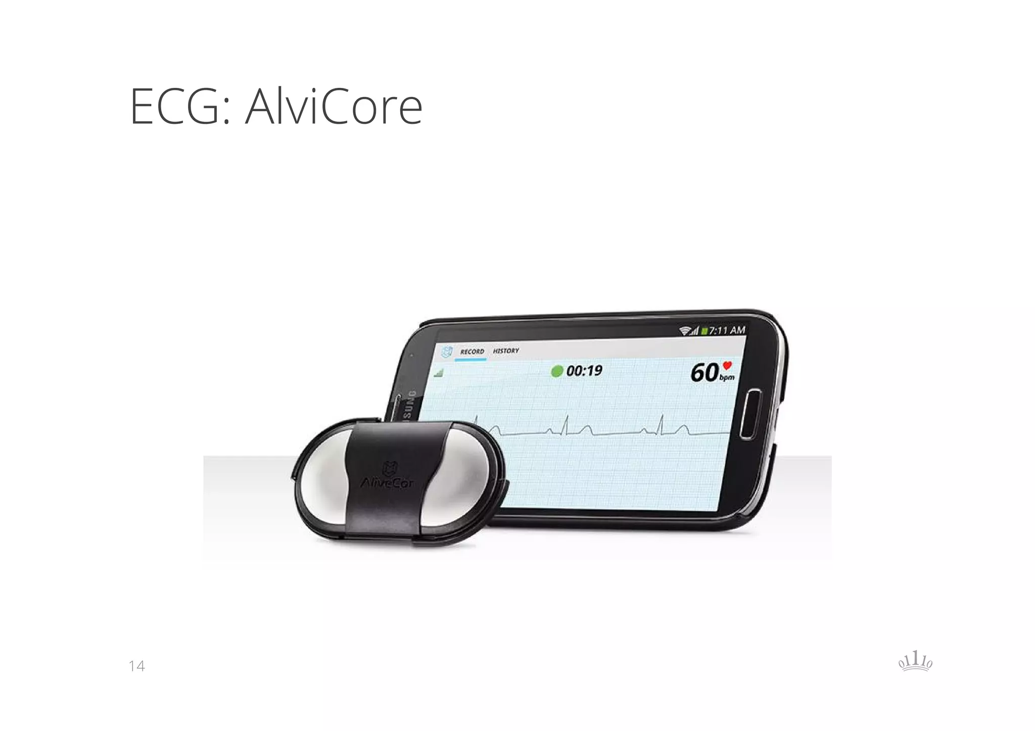 ECG: AlviCore

14

 