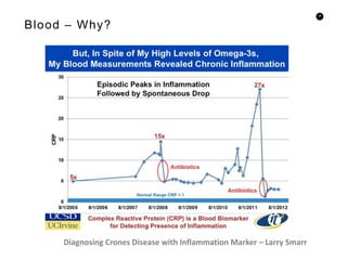 28
Blood – Why?
Diagnosing Crones Disease with Inflammation Marker – Larry Smarr
 