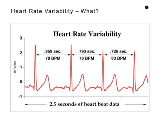 9
Heart Rate Variability – What?
 