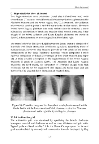 Monte Carlo model 
C  High‐resolution chest phantoms 
s  (voxel  sizeTwo  high‐resolution  voxel  phantom   0.97x0.97x0.6  mm)  were 
he manufacturer of the Kyoto Kagaku phantom claims that it is composed of 
created from CT scans of two different anthropomorphic thorax phantoms: the 
Alderson phantom and the Kyoto Kagaku PBU‐X‐21 phantom. The Alderson 
phantom was used in paper V and did not include smaller vessels. The more 
recent  Kyoto  Kagaku  phantom  was  more  realistic  since  it  contained  a  more 
human‐like distribution of small and medium‐sized vessels. Simulated x‐ray 
images  of  the  Zubal,  Alderson  and  Kyoto  Kagaku  phantoms  are  shown  in 
figure 3.4 demonstrating an increasing realism from left to right. 
 
T
materials  with  linear  attenuation  coefficients  (μ values)  resembling  those  of 
human tissues. However, they failed to provide us with details of the atomic 
compositions  of  the  tissue  substitute  materials,  which  complicate  a  more 
rigorous comparison with real x‐ray images of their chest phantom (see paper 
VI).  A  more  detailed  description  of  the  segmentation  of  the  Kyoto  Kagaku 
phantom  is  given  in  Malusek  (2008).  The  Alderson  and  Kyoto  Kagaku 
phantoms  are  used  mainly  for  simulation  of  synthetic  images  with  high 
resolution  but  are  not  yet  segmented  into  organs  and  tissue  types  and  can 
therefore not be used for direct calculation of effective dose. 
 
     
 
Figure 3.4. Projection images of the three chest voxel‐phantoms used in this 
 
.2.1.4  Anti‐scatter grid 
as  simulated  by  specifying  the  lamella  thickness, 
thesis. To the left the low‐resolution Zubal phantom, central the Alderson 
phantom and to the right the Kyoto Kagaku phantom. 
3
The  anti‐scatter  grid  w
interspace  material  and  thickness  as  well  as  cover  thickness  and  grid  ratio. 
Typical grids are listed in table 3.1. In the Monte Carlo program the focused 
grid was simulated by an analytical transmission formula developed by Day 
  13
 