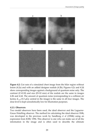 Assessment of image quality 
 
a                                                    b 
      
 
c                                                      d 
      
 
 
Figure 4.2. Cut outs of a simulated chest image from the hilar region without 
lesion (4.2a) and with an added designer nodule (4.2b). Figures 4.2c and 4.2d 
show corresponding images against a background of quantum noise only. The 
contrast (C=0.10) and size (D=10 mm) of the nodule are the same in images 
4.2b and 4.2d. The amount of quantum noise (corresponding to a collision air 
kerma Kc,air=0.3 μGy central in the image) is the same in all four images. The 
dose level is kept unrealistically low for illustration purposes. 
 
4.2.3. Observers 
Two model observers have been used, the ideal observer and the Laguerre‐
Gauss Hotelling observer. The method for calculating the ideal observer SNRI 
was  developed  in  the  previous  work  by  Sandborg  et  al  (1994b)  using  an 
expression from ICRU 1996. This observer is one who can make use of all the 
information  in  the  image  and  is  often  used  to  describe  the  ultimate 
  29
 