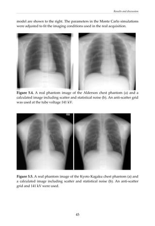 Results and discussion 
model are shown to the right. The parameters in the Monte Carlo simulations 
were adjusted to fit the imaging conditions used in the real acquisition. 
 
        
Figure  5.4.  A  real  phantom  image  of  the  Alderson  chest  phantom (a) and a 
calculated image including scatter and statistical noise (b). An anti‐scatter grid 
was used at the tube voltage 141 kV.  
 
Figure 5.5. A real phantom image of the Kyoto Kagaku chest phantom (a) and 
a  calculated  image  including  scatter  and  statistical  noise  (b).  An  anti‐scatter 
grid and 141 kV were used. 
 
  45
 