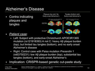 4 Sep 2022
Quantum Information
Alzheimer’s Disease
100
Source: Arboleda-Velasquez J.F., Lopera, F. O’Hare, M. et al. (2019...