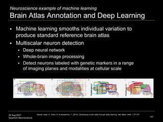 24 Aug 2021
Quantum Neuroscience
Neuroscience example of machine learning
Brain Atlas Annotation and Deep Learning
 Machi...