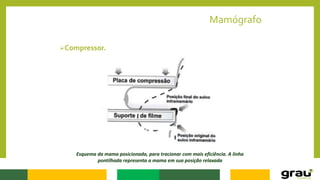 Mamógrafo
Compressor.
Esquema da mama posicionada, para tracionar com mais eficiência. A linha
pontilhada representa a mama em sua posição relaxada
 