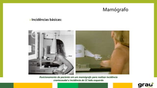 Mamógrafo
Incidências básicas:
Posicionamento da paciente em um mamógrafo para realizar incidência
craniocaudal e Incidência de CC lado esquerdo
 