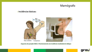 Mamógrafo
Incidências básicas:
Esquema da posição MLO e Posicionamento da incidência mediolateral oblíquo
 