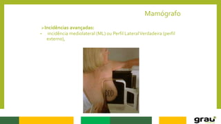 Mamógrafo
Incidências avançadas:
• incidência mediolateral (ML) ou Perfil LateralVerdadeira (perfil
externo),
 