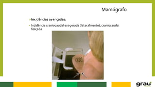 Mamógrafo
Incidências avançadas:
• Incidência craniocaudal exagerada (lateralmente), craniocaudal
forçada
 