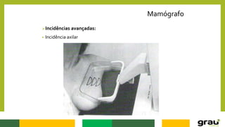 Mamógrafo
Incidências avançadas:
• Incidência axilar
 
