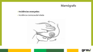 Mamógrafo
Incidências avançadas:
• Incidência craniocaudal rolada
 