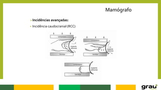 Mamógrafo
Incidências avançadas:
• Incidência caudocranial (RCC)
 