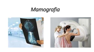 Mamografia
 
