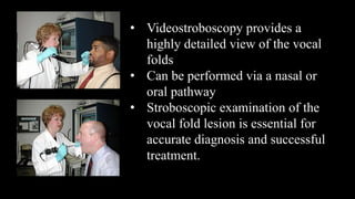 • Videostroboscopy provides a
highly detailed view of the vocal
folds
• Can be performed via a nasal or
oral pathway
• Stroboscopic examination of the
vocal fold lesion is essential for
accurate diagnosis and successful
treatment.
 
