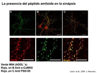La presencia del péptido amiloide en la sinápsis 
PSD-95 Ab Merged 
Verde M94 (ADDL´s) 
Rojo, en B Anti α-CaMKII 
Rojo ,en C Anti PSD-95 Lacor et al., 2004 J. Neurosci. 
 
