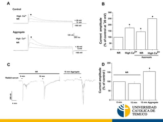B 
A 
C 
D 
+ 20 mV 
0 mV 
Control 
High Ca2+ 
NR 
Aggregate 
High Ca2+ 
NR 
-100 mV 
+ 20 mV 
0 mV 
-100 mV 
100 nA 
250 ms 
Rabbit serum 
4 min 
200 nA 
15 min Aggregate 
NR 
0 min 15 min 
300 
250 
200 
150 
100 
50 
0 
NR 2+ 
High Ca 
Aggregate 
* 
* 
Current amplitude 
(% of control at +20 mV) 
* 
NR High Ca 
2+ 
200 
150 
100 
50 
0 
* 
15 min 15 min Aggregate 
Current amplitude 
(% of control ) 
NR 
0 min 
 