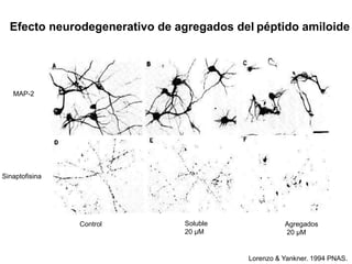 Efecto neurodegenerativo de agregados del péptido amiloide 
Lorenzo & Yankner. 1994 PNAS. 
MAP-2 
Sinaptofisina 
Control Soluble 
20 μM 
Agregados 
20 μM 
 