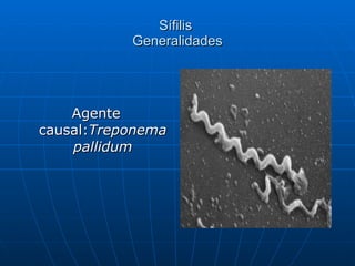 Sífilis  Generalidades Agente causal: Treponema pallidum 