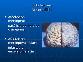 Sífilis terciaria Neurosífilis Afectación meníngea: parálisis de nervios craneanos Afectación meningovascular: infartos y encefalomalacia 