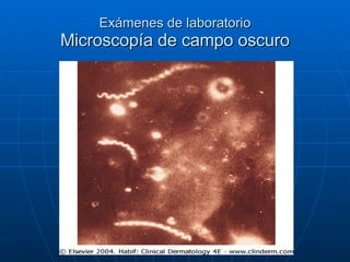 Exámenes de laboratorio Microscopía de campo oscuro 
