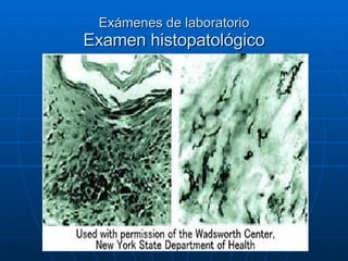 Exámenes de laboratorio Examen histopatológico 