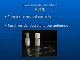 Exámenes de laboratorio VDRL Muestra: suero del paciente Reactivos de laboratorio con antígenos 