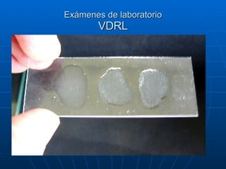 Exámenes de laboratorio VDRL 