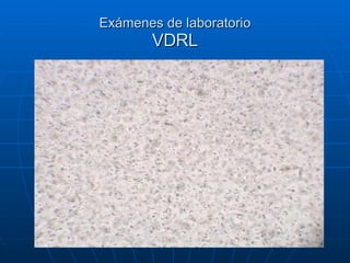 Exámenes de laboratorio VDRL 