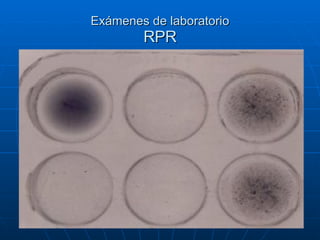 Exámenes de laboratorio RPR 