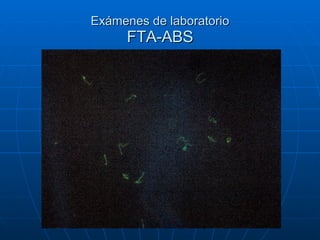 Exámenes de laboratorio FTA-ABS 