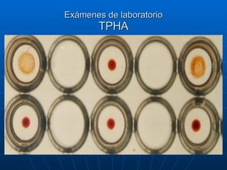 Exámenes de laboratorio TPHA 