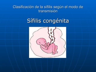 Clasificación de la sífilis según el modo de transmisión Sífilis congénita 