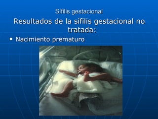 Sífilis gestacional Resultados de la sífilis gestacional no tratada: Nacimiento prematuro 