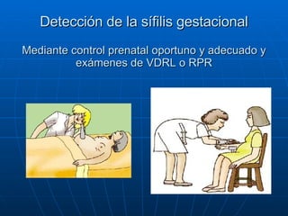 Detección de la sífilis gestacional Mediante control prenatal oportuno y adecuado y exámenes de VDRL o RPR 