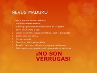 NEVUS MADURO
 