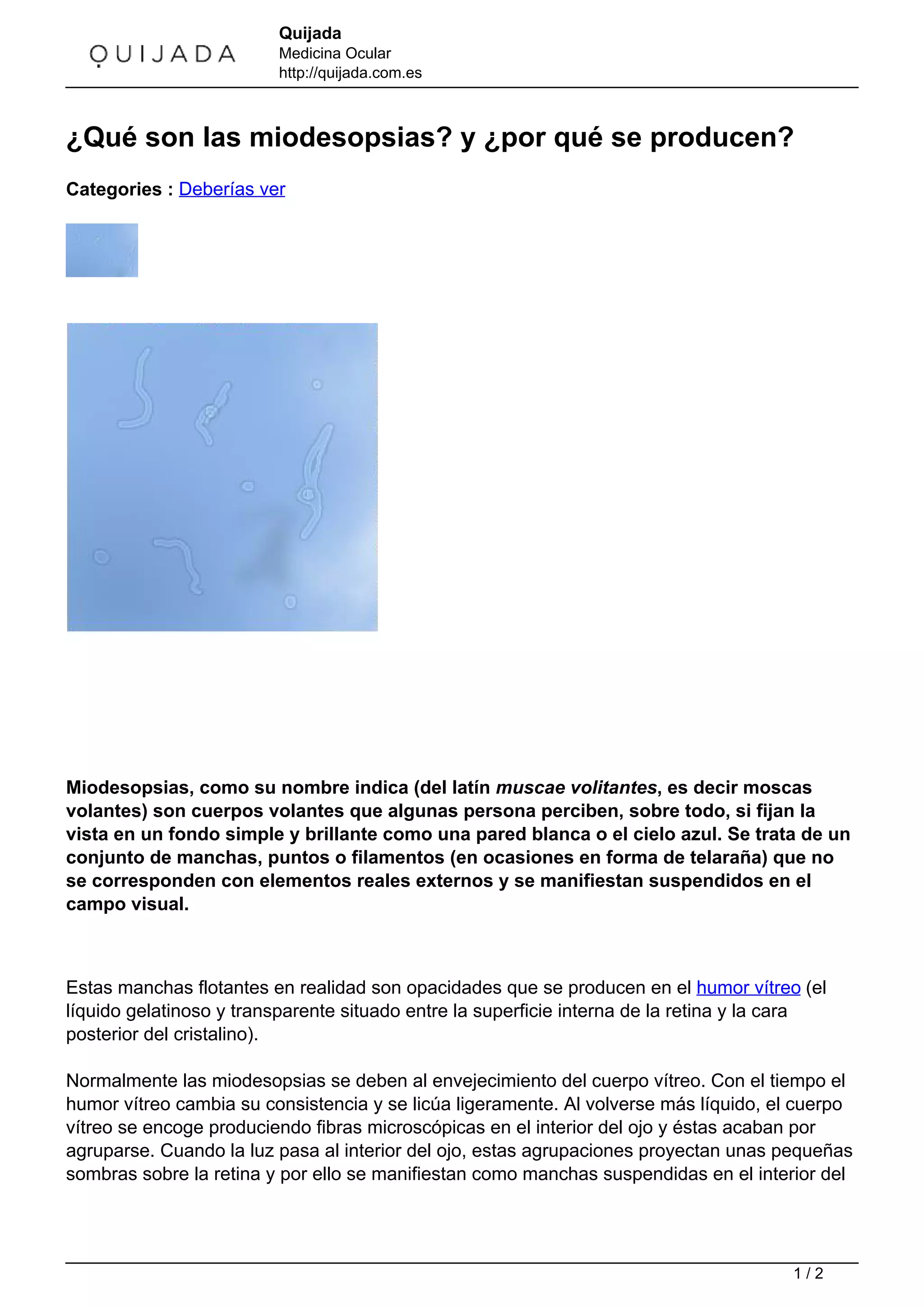 Que son-las-miodesopsias | PDF | Eye and Vision Conditions | Diseases ...