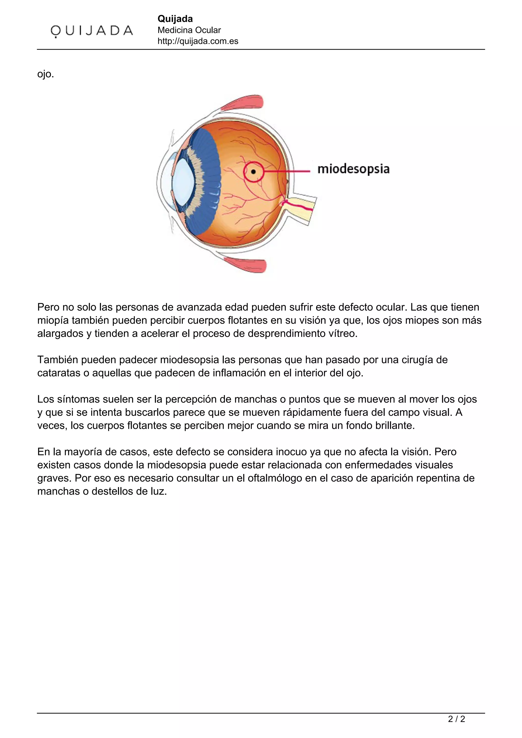 Que son-las-miodesopsias | PDF | Eye and Vision Conditions | Diseases ...